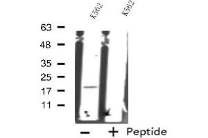 Western blot analysis of extracts from K562 cells, using RPS18 antibody. (RPS18 Antikörper)