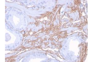 Formalin-fixed, paraffin-embedded human Prostate stained with Decorin Mouse Monoclonal Antibody (DCN/3523). (Decorin Antikörper  (AA 212-336))