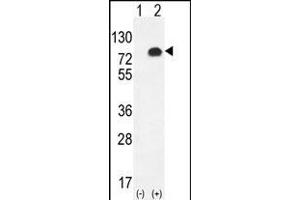 Western blot analysis of GPC6 (arrow) using rabbit polyclonal GPC6 Antibody (C-term) (ABIN655620 and ABIN2845100). (Glypican 6 Antikörper  (C-Term))