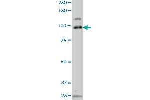 SRPK1 monoclonal antibody (M10A), clone 4G12 Western Blot analysis of SRPK1 expression in Jurkat . (SRPK1 Antikörper  (AA 371-470))