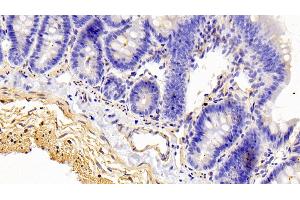 Detection of CALD in Rat Colon Tissue using Polyclonal Antibody to Caldesmon (CALD) (Caldesmon Antikörper  (AA 434-531))