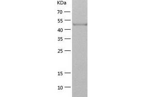 Western Blotting (WB) image for SHC (Src Homology 2 Domain Containing) Transforming Protein 1 (SHC1) (AA 1-474) protein (His tag) (ABIN7125085) (SHC1 Protein (AA 1-474) (His tag))