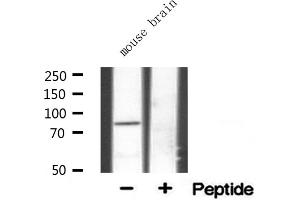 Western blot analysis of extracts from mouse brian, using ALS2CR8 antibody. (CDKN2AIP Antikörper  (Internal Region))