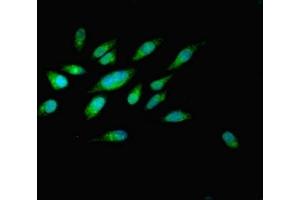 Immunofluorescent analysis of Hela cells using ABIN7162519 at dilution of 1:100 and Alexa Fluor 488-congugated AffiniPure Goat Anti-Rabbit IgG(H+L) (PILRB Antikörper  (AA 20-191))