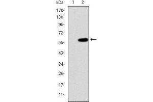 Western Blotting (WB) image for anti-Mitogen-Activated Protein Kinase Kinase Kinase 2 (MAP3K2) antibody (ABIN969272)