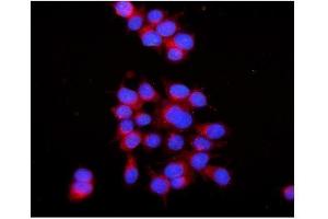 IF analysis of RAB7 using anti-RAB7 antibody (ABIN3044538).