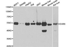 Western blot analysis of extracts of various cell lines, using DARS antibody.