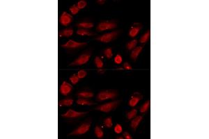 Immunofluorescence analysis of U20S cell using TP53BP1 antibody. (TP53BP1 Antikörper)