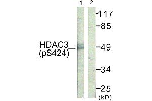 Immunohistochemistry analysis of paraffin-embedded human skin tissue using HDAC3 (Phospho-Ser424) antibody. (HDAC3 Antikörper  (pSer424))