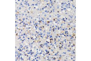 Immunohistochemistry of paraffin-embedded human spleen using CD11a/LFA-1A/ITGAL Rabbit mAb (ABIN7267923) at dilution of 1:100 (40x lens).