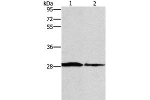Western Blot analysis of Human chromaffin cell tumor tissue and lovo cell using SPR Polyclonal Antibody at dilution of 1:1500 (SPR Antikörper)