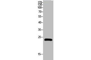 Western Blot analysis of HELA cells using Claudin-5 Polyclonal Antibody (Claudin 5 Antikörper  (C-Term))