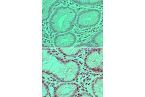 Image no. 1 for anti-Ubiquitin Specific Peptidase 7 (Herpes Virus-Associated) (USP7) (AA 30-80) antibody (ABIN960400)