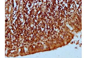 IHC image of ABIN7157277 diluted at 1:300 and staining in paraffin-embedded human lung tissue performed on a Leica BondTM system. (KLHL2 Antikörper  (AA 1-200))
