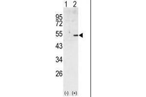 Western blot analysis of CCNA2 (arrow) using rabbit polyclonal CCNA2 Antibody (Cyclin A Antikörper  (C-Term))