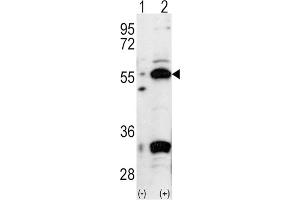Western Blotting (WB) image for anti-Pancreatic and Duodenal Homeobox 1 (PDX1) antibody (ABIN3001418)