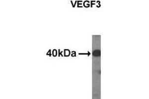 Western analysis of extracts from HDMEC cells using VEGF3 antibody. (VEGFC Antikörper  (C-Term, N-Term))