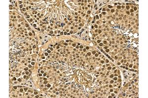 ABIN7094357 and ABIN7098404 at 1/100 staining Mouse testis tissue by IHC-P.