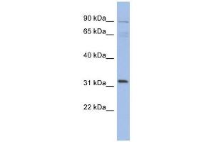 TBC1D14 antibody used at 1 ug/ml to detect target protein. (TBC1D14 Antikörper  (N-Term))