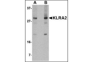 Western blot analysis of KLRA2 in mouse spleen tissue lysate with this product at (A) 0.