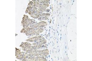 Immunohistochemistry of paraffin-embedded mouse stomach using ATP1B1 antibody (ABIN5973412) at dilution of 1/100 (40x lens). (ATP1B1 Antikörper)