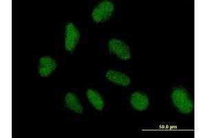 Immunofluorescence of purified MaxPab antibody to NAP1L3 on HeLa cell.