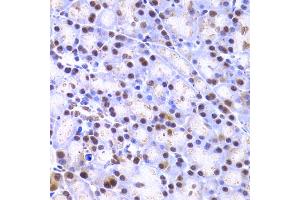 Immunohistochemistry of paraffin-embedded rat pancreas using XRCC4 Antibody (ABIN5970836) at dilution of 1/200 (40x lens). (XRCC4 Antikörper)