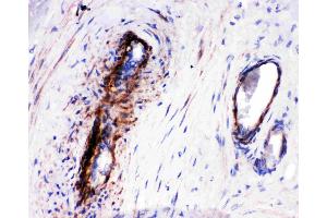 Anti-LASP1 antibody, IHC(P): Human Placenta Tissue
