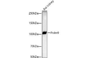 Western blot analysis of extracts of Rat kidney, using Prdm9 antibody (ABIN7269500) at 1:1000 dilution. (PRDM9 Antikörper)