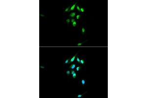 Immunofluorescence analysis of U2OS cells using NR3C1 antibody. (Glucocorticoid Receptor Antikörper  (AA 1-280))