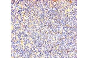 Immunohistochemistry of paraffin-embedded human lymphoid tissue using ABIN7147985 at dilution of 1:100 (COTL1 Antikörper  (AA 2-142))