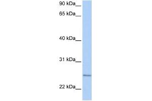 WB Suggested Anti-RABL4 Antibody Titration:  0. (RABL4 Antikörper  (C-Term))