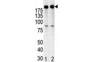 Western blot analysis of anti-HER2 in T47D cell lysate, either noninduced (Lane 1) or induced with HRG (2). (ErbB2/Her2 Antikörper  (AA 1227-1255))