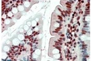 Image no. 2 for anti-Ewing Sarcoma Breakpoint Region 1 (EWSR1) (Internal Region) antibody (ABIN375098) (EWSR1 Antikörper  (Internal Region))