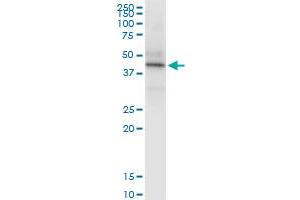 Immunoprecipitation of HLA-C transfected lysate using rabbit polyclonal anti-HLA-C and Protein A Magnetic Bead (HLA-C (Human) IP-WB Antibody Pair)