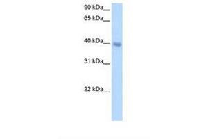Image no. 2 for anti-Distal-Less Homeobox 5 (DLX5) (AA 120-169) antibody (ABIN6737699)