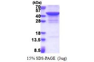 SDS-PAGE (SDS) image for Jumonji Domain Containing 7 (JMJD7) (AA 1-316) protein (His tag) (ABIN5853360)
