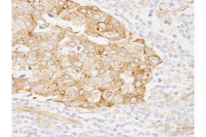Immunohistochemistry (IHC) image for anti-Reticulocalbin 1, EF-Hand Calcium Binding Domain (RCN1) (AA 1-75) antibody (ABIN7449011) (RCN1 Antikörper  (AA 1-75))