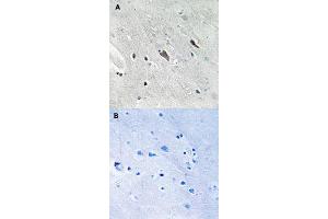 Immunohistochemical staining of human brain tissue by GAB2 (phospho Y643) polyclonal antibody  without blocking peptide (A) or preincubated with blocking peptide (B) under 1:50-1:100 dilution. (GAB2 Antikörper  (pTyr643))