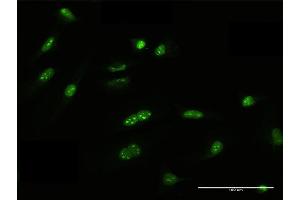 Immunofluorescence of purified MaxPab antibody to FRG1 on HeLa cell.