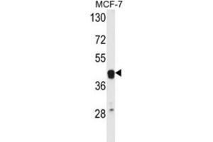 Western Blotting (WB) image for anti-V-Ets Erythroblastosis Virus E26 Oncogene Homolog 2 (ETS2) antibody (ABIN3004344) (ETS2 Antikörper)