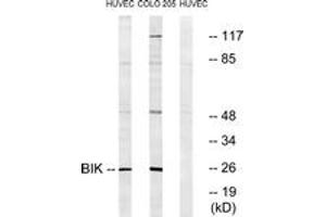 Western blot analysis of extracts from HuvEc/COLO205, using BIK (Ab-33) Antibody.