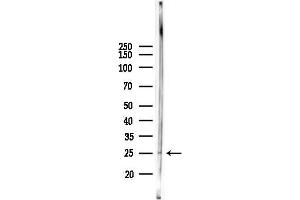 anti-Activating Transcription Factor 3 (ATF3) (C-Term) antibody