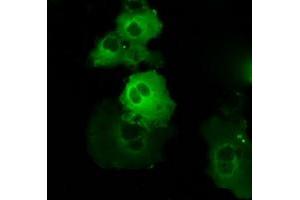 Image no. 9 for anti-Bruton Agammaglobulinemia tyrosine Kinase (BTK) antibody (ABIN1496974) (BTK Antikörper)