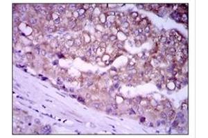 Immunohistochemistry (IHC) image for anti-Glypican 3 (GPC3) antibody (ABIN1107403) (Glypican 3 Antikörper)