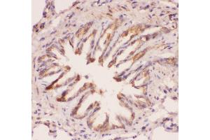 Anti-MyD88 Picoband antibody,  IHC(P): Rat Lung Tissue (MYD88 Antikörper  (AA 44-264))