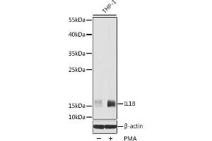 Western blot analysis of extracts of THP-1 cells using IL1 beta Polyclonal Antibody at dilution of 1:1000. (IL-1 beta Antikörper)