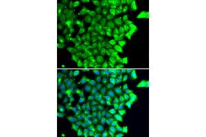 Immunofluorescence analysis of MCF7 cell using TRIAP1 antibody. (TRIAP1 Antikörper)