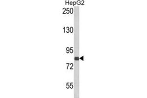 Western Blotting (WB) image for anti-Endothelin-Converting Enzyme 1 (ECE1) antibody (ABIN3002835) (ECE1 Antikörper)