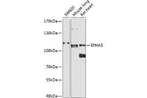 Western blot analysis of extracts of various cell lines, using EPH antibody (ABIN6131627, ABIN6140213, ABIN6140214 and ABIN6224468) at 1:1000 dilution. (EPH Receptor A3 Antikörper  (AA 400-545))